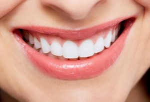Close up of a whitened smile