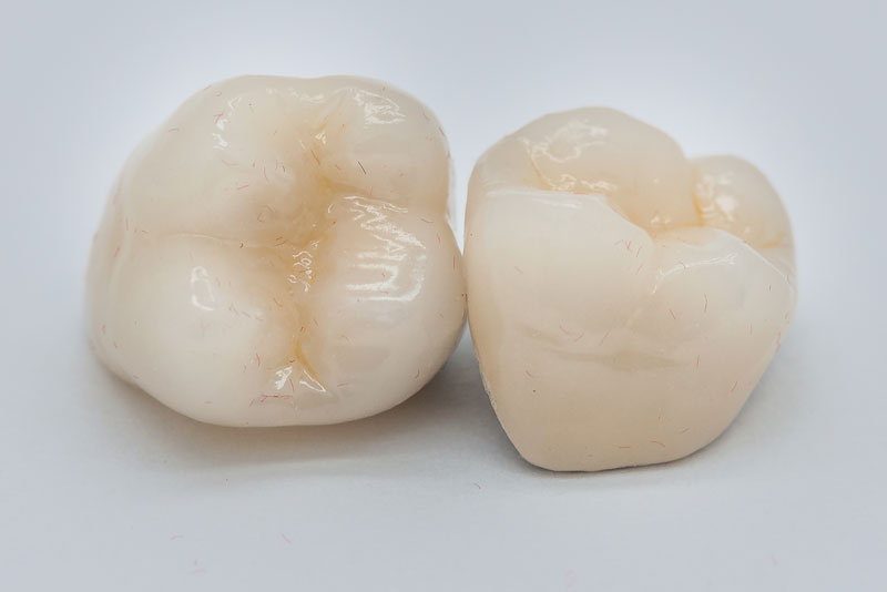 Zirconia Crowns