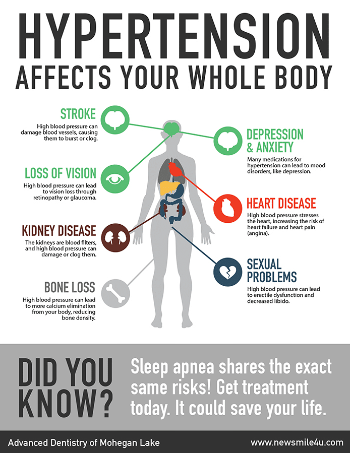 Spreading Important Sleep Apnea Information with an Infographic