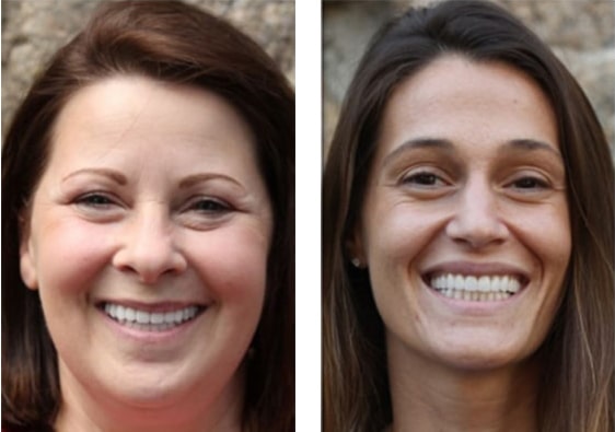 Introducing the Smile Makeover | Dentist Tarrytown