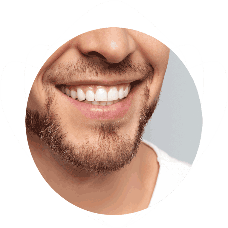close up of a dental patient smiling after his smile makeover