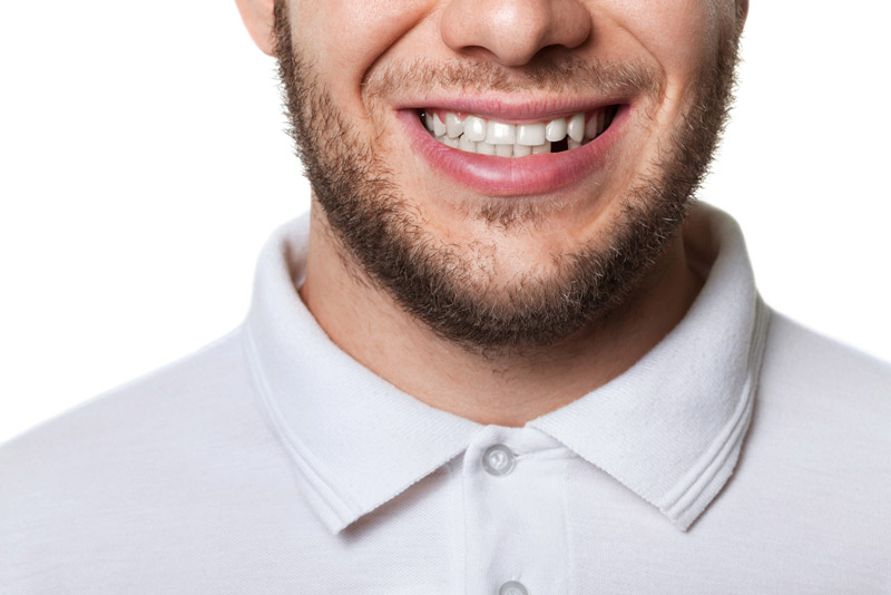 Dental Patient Missing His Tooth