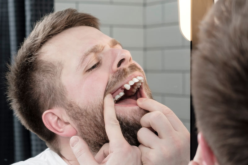 Dental Implant Patient Missing His First Upper Premolar