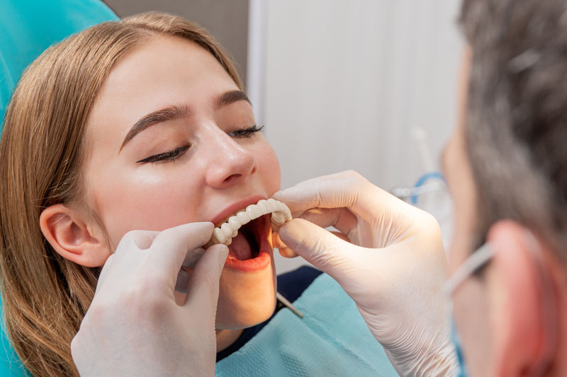 a picture of a doctor placing a full mouth dental implant prosthesis in the patients mouth during her anxiety-free full mouth dental implant procedure with sedation dentistry.