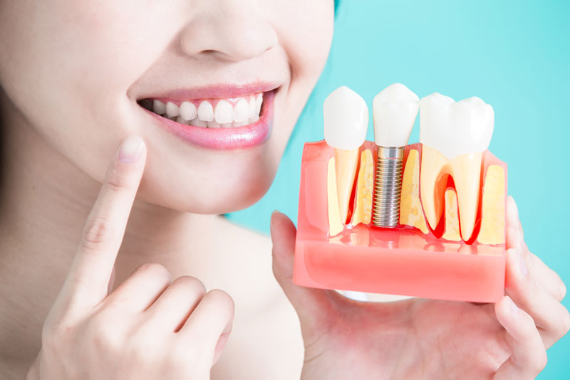 a patient holding a dental implant model as she points to her smile to show how different types of dental implant treatments can restore her smile.