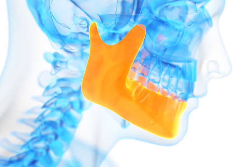 an x-ray image of a patients skeletal profile that highlights in orange where the patient has TMJ disorder.