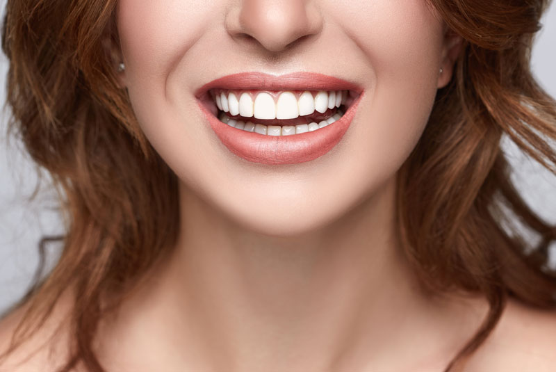 a happy woman showing off her beautiful new smile after getting treated with a smile makeover.