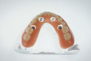 dental implant full arch with 4 holes for implants to be placed into the arch