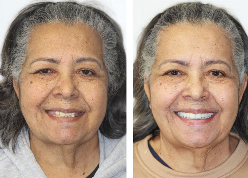 before and after